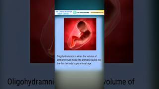 Oligohydramnios || Low amniotic fluid during Pregnancy healthtips babycaretips pregnancycare