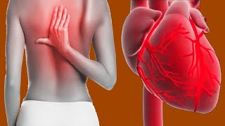 Can A Heart Attack Cause Back Pain