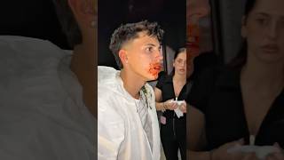 Creéis Que Se Va A Convertir En Zombie?