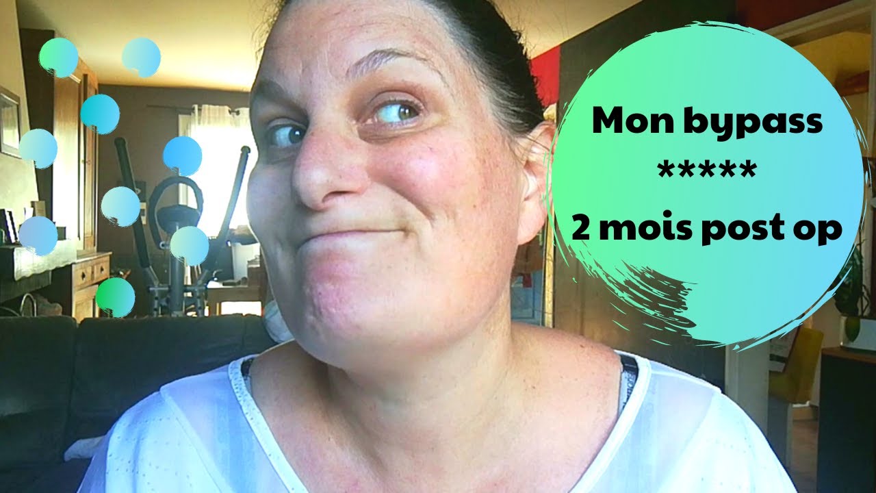 Bypass 2020 : 2 mois postopératoire, combien de kilos perdus, les avantages et inconvénients...
