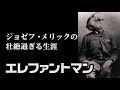 エレファントマン    その壮絶過ぎる生涯  The Elephant Man　【英国ぶら歩き】