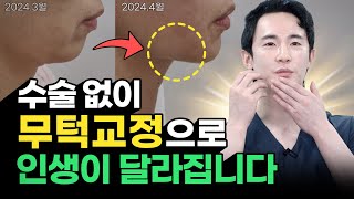 👍무턱필러 턱 끝 필러 말고 이거 하세요!👍수술 없이 간단하게 무턱교정하는 법