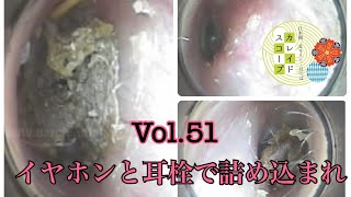 【耳かき】Vol.51 イヤホンと毎日の耳栓で押し込んだお耳