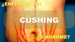 ¿Síndrome de Cushing o Enfermedad de Cushing? Diferencias