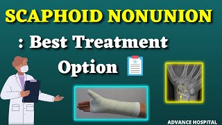 Best Treatment for NonUnion of Scaphoid bone. Dr Prathmesh Jain screenshot 1