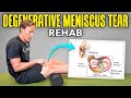 4 rehab exercises for a degenerative meniscus tear