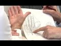 How it works: Carpal tunnel syndrome surgery