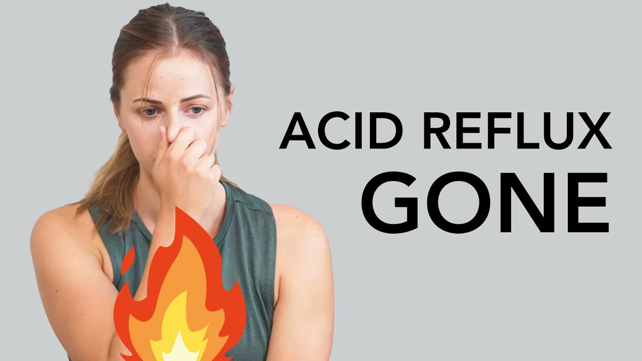 Heartburn Remedies (HOW TO TREAT ACID REFLUX WITHOUT MEDICINE) 