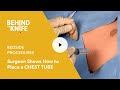 Surgeon shows how to place a chest tube  behind the knife  bedside procedures episode 1