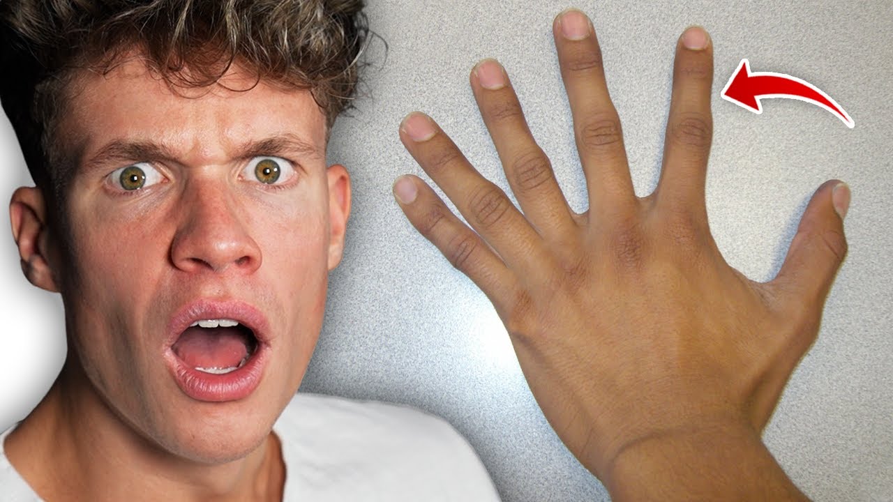 Menschen mit ZUSÄTZLICHEN Körperteilen