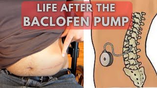 From uncontrollable spasms to relaxed limbs | Life before and after a Baclofen Pump
