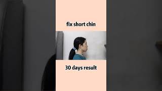 30 days fixing receding chin | mewing and short chin exercise shorts