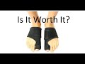 Bunion Splints and Correctors: Are They Worth It? [Doctor Review]