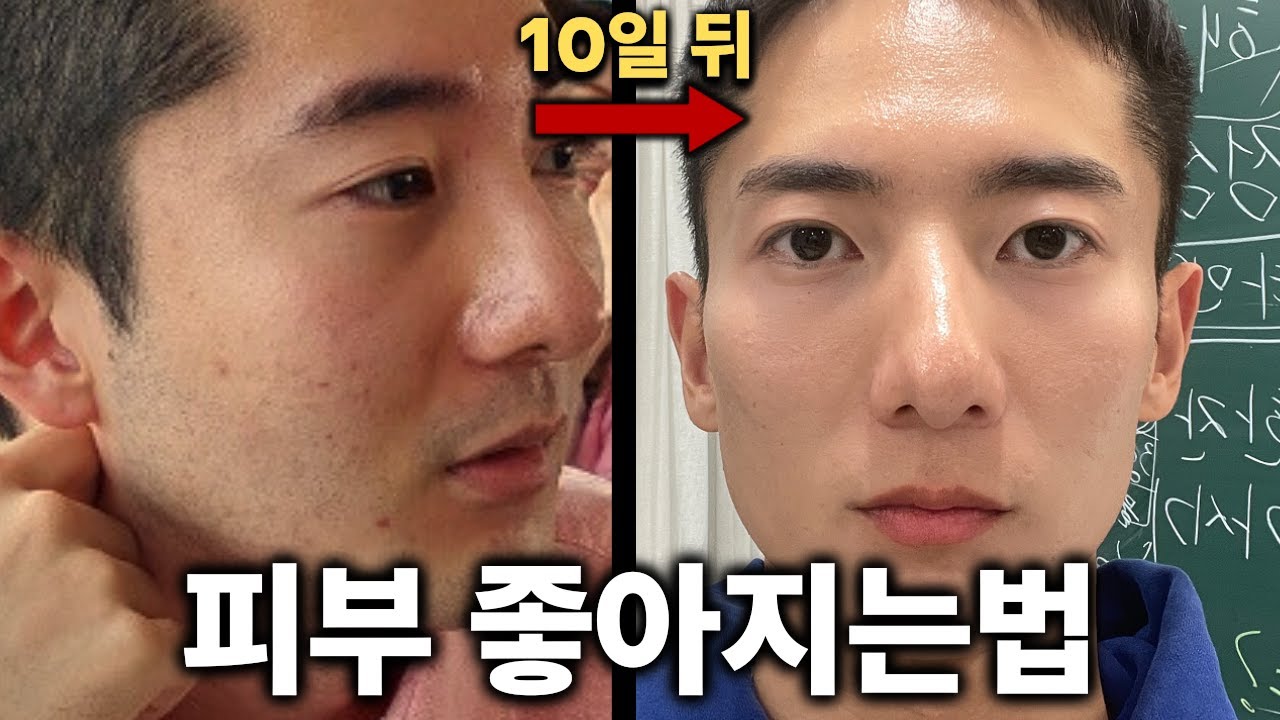 10일만에 피부 좋아집니다. 아침, 점심, 저녁 필수 루틴 (여드름 안나는법)