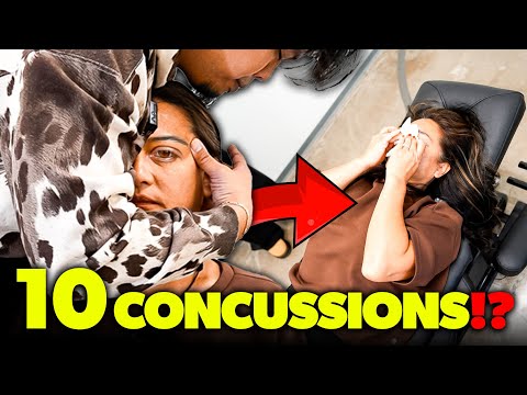 **NO MIGRAINE** 1ST TIME IN 45+ YEARS! 😱😭  | Dr Tubio | 1st Chiropractic Adjustment