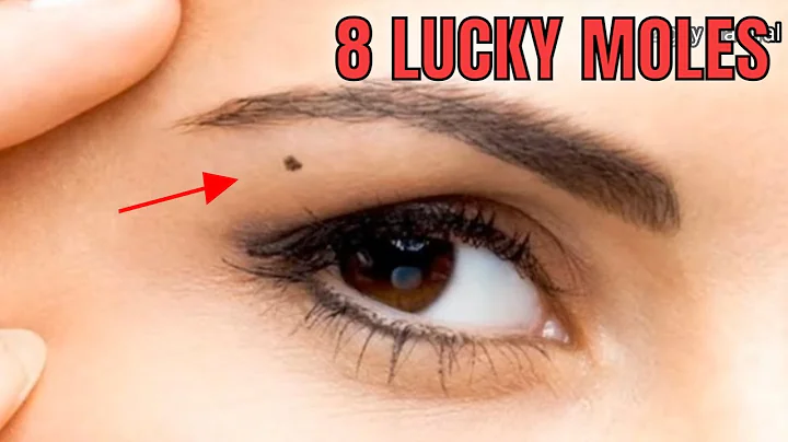 You Are Considered Really Lucky If You Have Moles On These 8 Body Parts - Maswerteng Nunal - DayDayNews