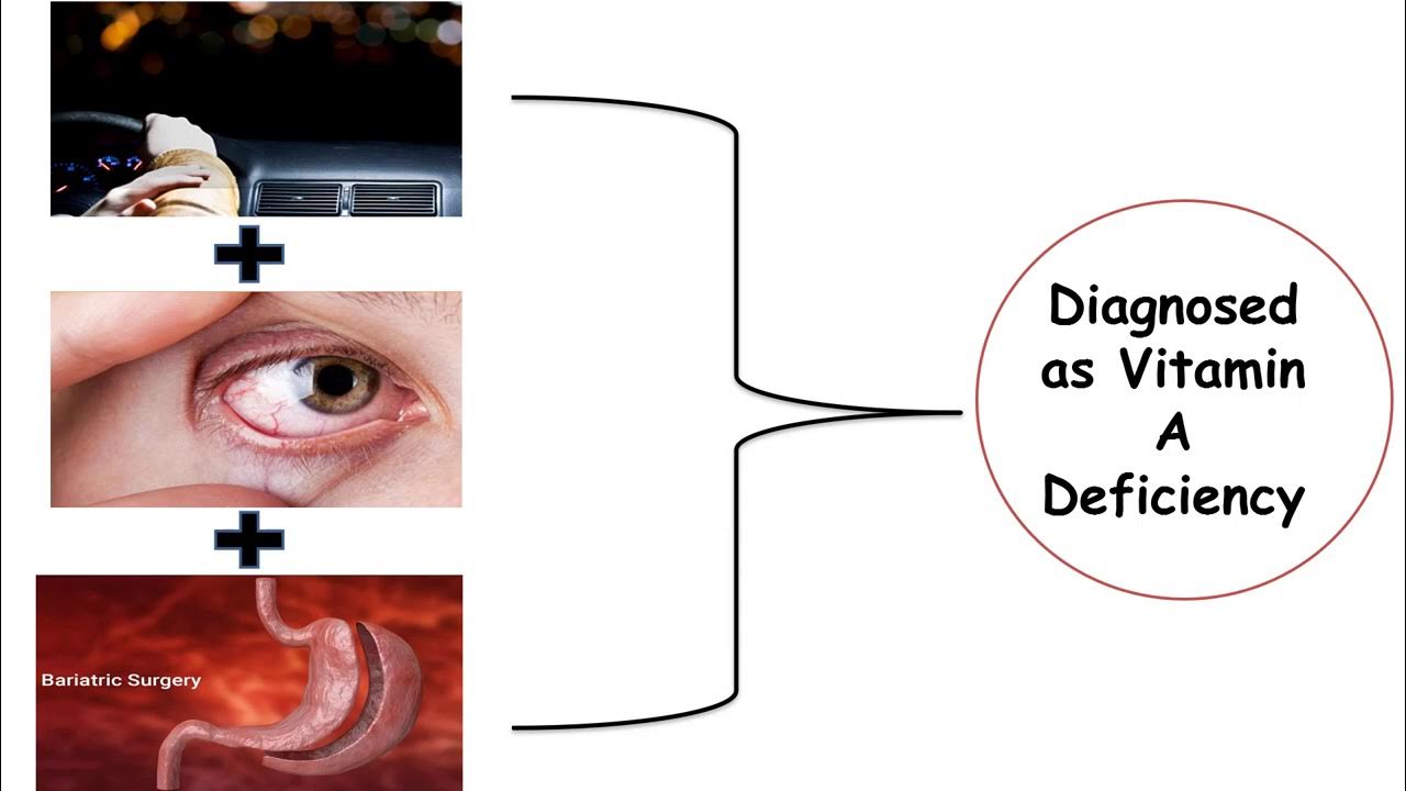 MED.LEVEL 2. GIT module. BIO Lecture 6 Vitamins (part1) YouTube
