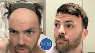 Hair System Maintenance & Work Out/Sports | Non-Surgical Hair Replacement System Men/Women UK/USA