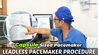 Inside a Dual Chamber Leadless Pacemaker Procedure 🫀 | Dr. Amit Bhushan Sharma