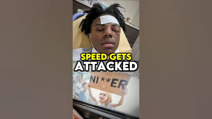 IShowSpeed Fans Went TOO FAR 😳