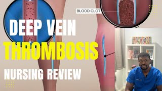 Deep Vein Thrombosis | DVT | Nursing Review 