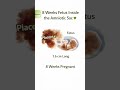 8 Weeks Fetus Inside the Amniotic Sac Early Pregnancy Development #pregnancy #8weeks #baby .