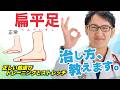 【扁平足 を治せ！ 】子供 の扁平足も安心！土踏まず の作り方・靴 とインソール の選び方・治し方 のポイント