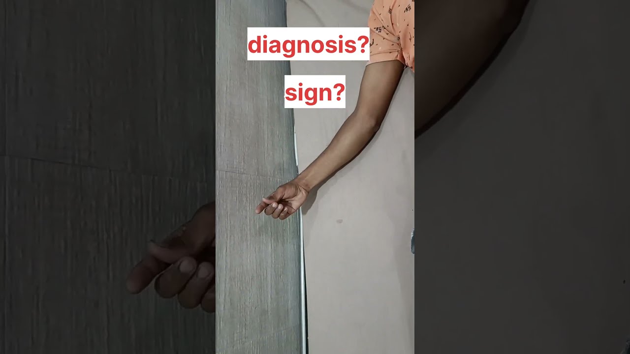 Hypocalcemia Spasm In Hands Shorts Medicine