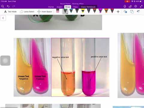 continued urease test microbiology youtube urease test