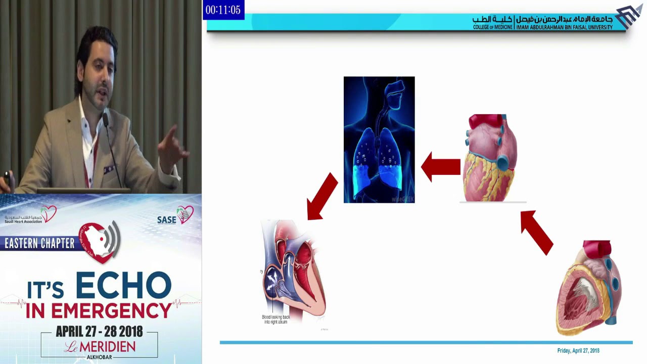 Роль эхокардиографии в оценке давления наполнения левого желудочка