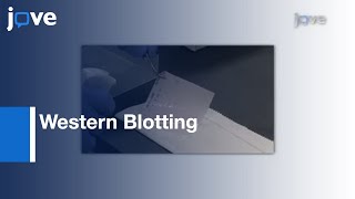 Western Blotting: Sample Preparation To Detection l Protocol Preview