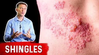 Why Is Everyone Getting Shingles?