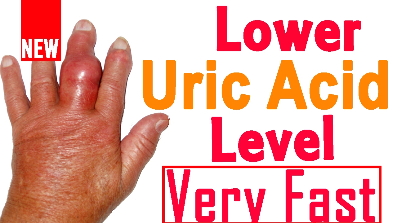 Home Remedies To Reduce Uric Acid How To Lower Uric Acid Naturally Youtube