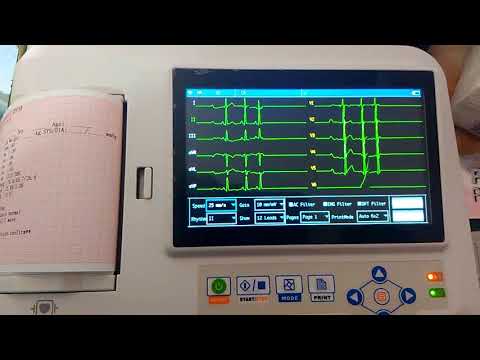 6 channel E.C.G operating