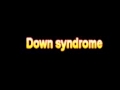 What Is The Definition Of Down syndrome - Medical Dictionary Free Online