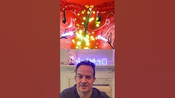 How to remove a splinter! 🤯