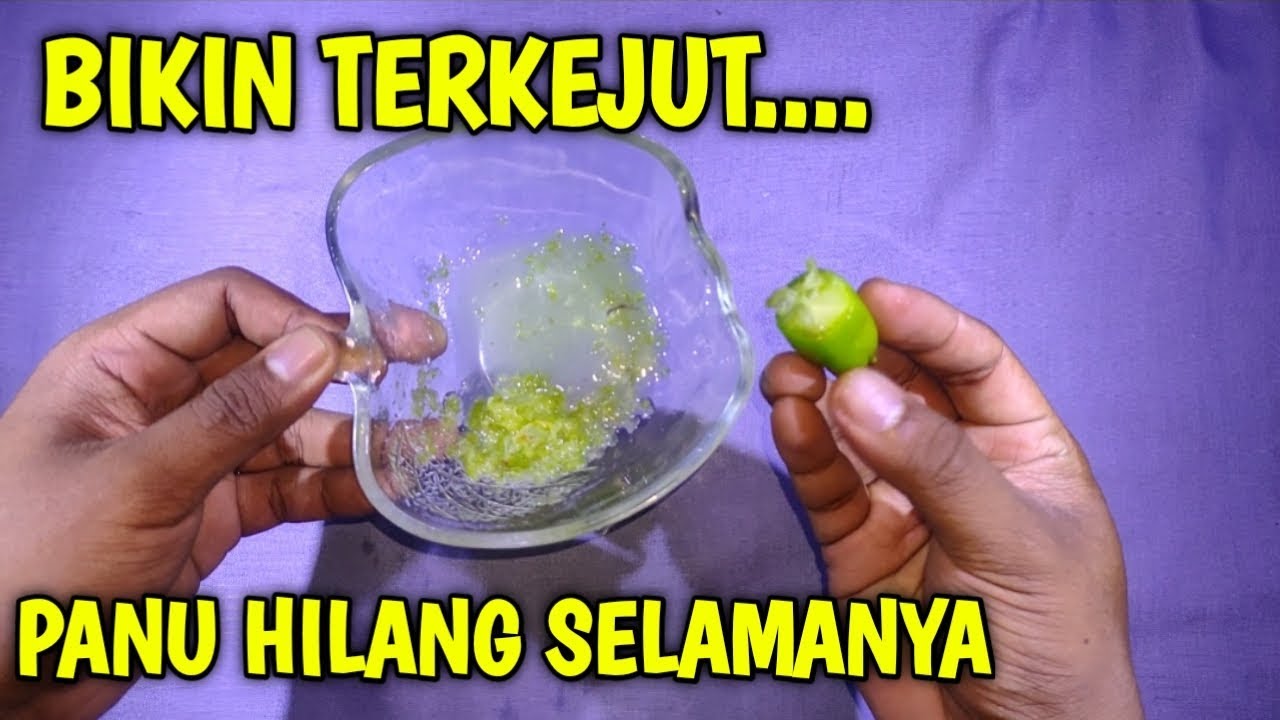 Cara mengatasi panu di kulit dengan cepat, Menghilangkan panu secara