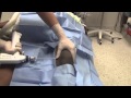 Hip Dislocation Reduction and Traction Pinning