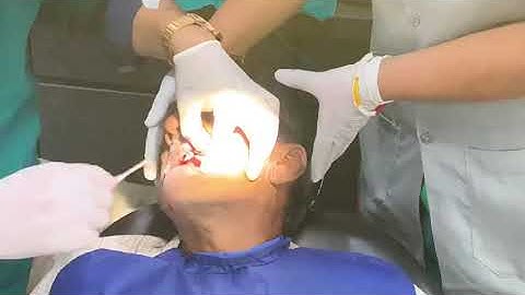 Bio care basal implant