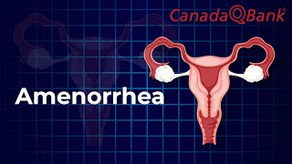 Amenorrhea