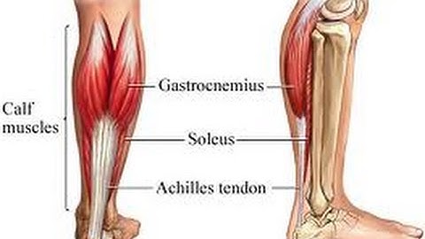 Myofascial Pain Trigger Points pt. 14 Soleus