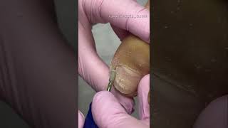 Обработка кутикулы в педикюре #педикюр #ногти #гельлак #nails #pedicure #подолог #подология