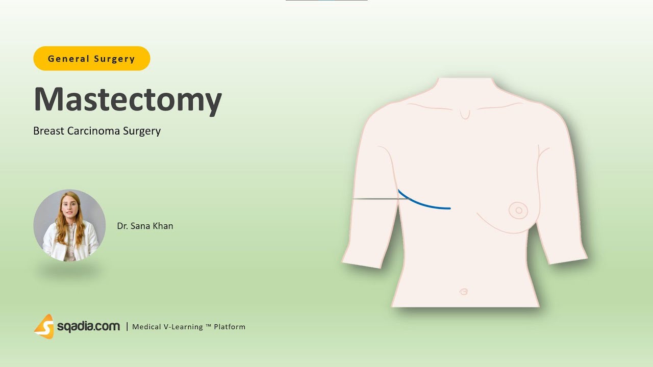 Breast Carcinoma Surgery | Mastectomy