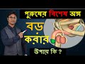 পুরুষাঙ্গ বড় করার উপায় - সাইজ বৃদ্ধির উপায় - Penis size Bangla  | Dr Shamim Hosen