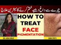 How to treat face pigmentation  chehre ke daagh dhabon ka ilaj kia hai dr aisha ghias