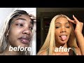 I spent $1000 to look less ugly | glow up challenge