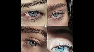 Thumbnail of Brown eye in sun😭✨ || #1million #viralvideo #relatable #vieloz #neighborhood #browneyes ||