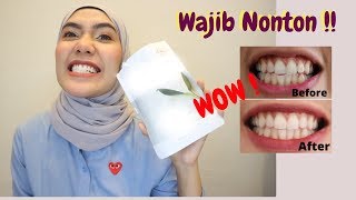 Cara Memutihkan Gigi ala Artis! Beneran Putih?? | Achtasya Iman