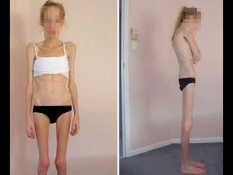 Inyectable grasa quemador de abdominal