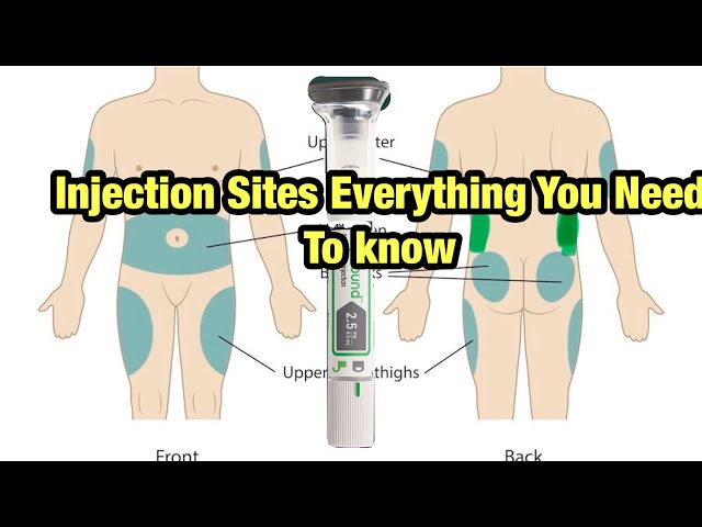 Injection Sites GLP1: Myths Busted, Best Options, Tips and Tricks For Maximum Weight Loss